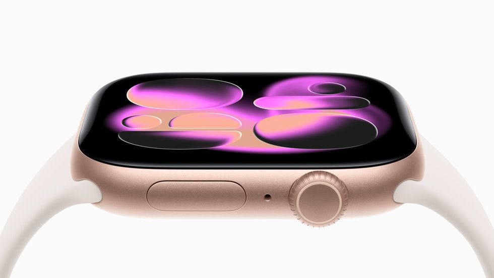 Apple-Watch-Series-11-hero-250909_big.jpg.large.jpg